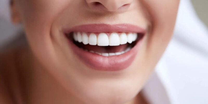 how to naturally whiten your teeth at home